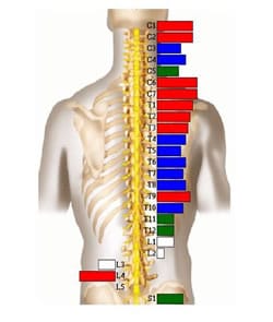 Subluxation test